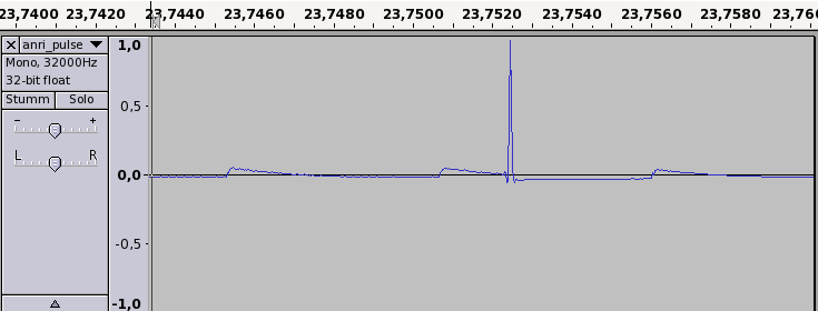 x31: signal gut, zoom