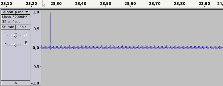 x31: signal gut